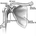 Shoulder_Arthroplasty-1